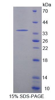 MCAD / ACADM Protein - Recombinant Acyl Coenzyme A Dehydrogenase, C4-To-C12 Straight Chain (ACADM) by SDS-PAGE