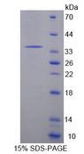 MCAD / ACADM Protein - Recombinant Acyl Coenzyme A Dehydrogenase, C4-To-C12 Straight Chain (ACADM) by SDS-PAGE