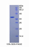 MCAM / CD146 Protein - Recombinant Melanoma Cell Adhesion Molecule By SDS-PAGE