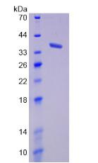MCL1 / MCL 1 Protein - Recombinant Myeloid Cell Leukemia Sequence 1, Bcl2 Related By SDS-PAGE