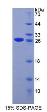 MCM3 Protein - Recombinant Minichromosome Maintenance Deficient 3 (MCM3) by SDS-PAGE