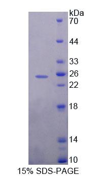 MEF2A / MEF2 Protein - Recombinant Myocyte Specific Enhancer Factor 2A By SDS-PAGE