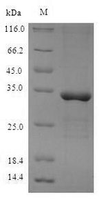 METRNL Protein - (Tris-Glycine gel) Discontinuous SDS-PAGE (reduced) with 5% enrichment gel and 15% separation gel.