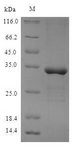 METRNL Protein - (Tris-Glycine gel) Discontinuous SDS-PAGE (reduced) with 5% enrichment gel and 15% separation gel.