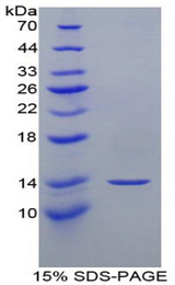 MFAP5 / MAGP2 Protein - Recombinant Microfibrillar Associated Protein 5 By SDS-PAGE