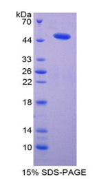 MGST1 Protein - Recombinant Microsomal Glutathione S Transferase 1 By SDS-PAGE