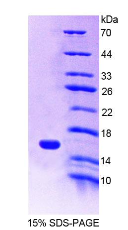 MIA / CD-RAP Protein - Recombinant  Melanoma Inhibitory Activity Protein 1 By SDS-PAGE