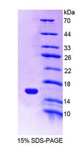 MIA / CD-RAP Protein - Recombinant  Melanoma Inhibitory Activity Protein 1 By SDS-PAGE