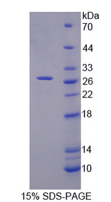 MID1 Protein - Recombinant Midline 1 By SDS-PAGE