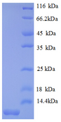 MIP2 / GRO2 / CXCL2 Protein