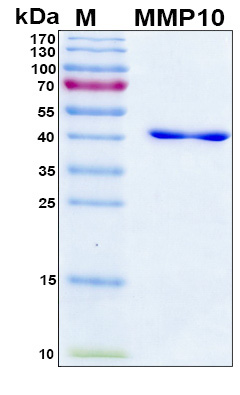 MMP10 Protein - SDS-PAGE under reducing conditions and visualized by Coomassie blue staining