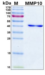 MMP10 Protein - SDS-PAGE under reducing conditions and visualized by Coomassie blue staining
