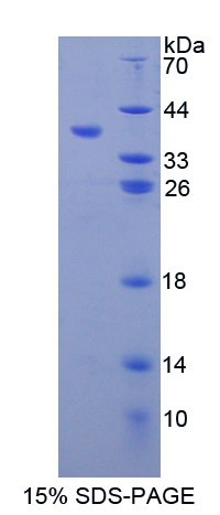 MMP10 Protein - Recombinant  Matrix Metalloproteinase 10 By SDS-PAGE