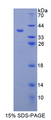 MMP10 Protein - Recombinant  Matrix Metalloproteinase 10 By SDS-PAGE