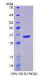 MMP12 Protein