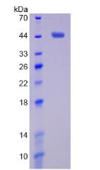 MMP14 Protein - Recombinant Matrix Metalloproteinase 14 By SDS-PAGE