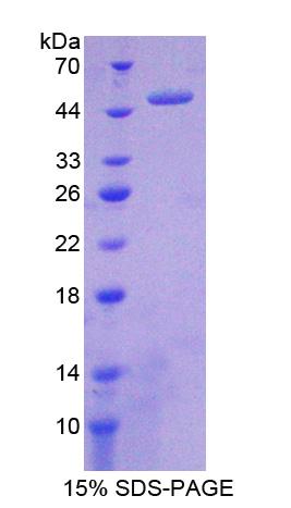 MMP19 Protein - Recombinant  Matrix Metalloproteinase 19 By SDS-PAGE