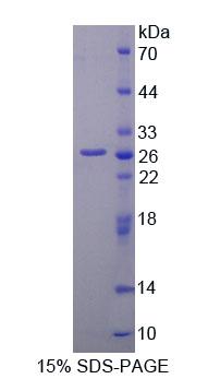 MMP2 Protein - Recombinant Matrix Metalloproteinase 2 (MMP2) by SDS-PAGE