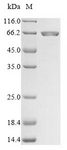 MMP24 Protein - (Tris-Glycine gel) Discontinuous SDS-PAGE (reduced) with 5% enrichment gel and 15% separation gel.