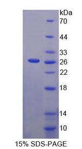MMRN2 / Emilin 3 / EndoGlyx-1 Protein - Recombinant  Multimerin 2 By SDS-PAGE