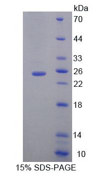 MOCS1 Protein - Recombinant Molybdenum Cofactor Synthesis 1 By SDS-PAGE