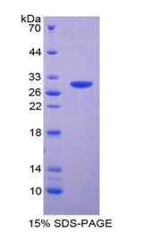 MOK / RAGE Protein - Recombinant Renal Tumor Antigen By SDS-PAGE