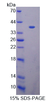 MPEG1 Protein - Recombinant  Macrophage Expressed Protein 1 By SDS-PAGE