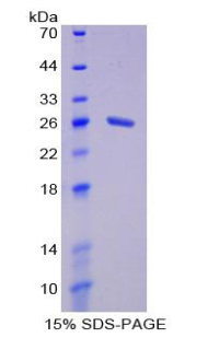 MPHOSPH6 Protein - Recombinant Membrane Protein, Palmitoylated 6 By SDS-PAGE