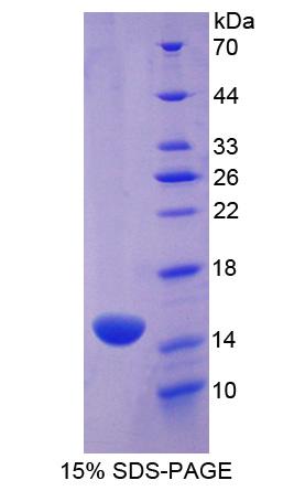 MPO / Myeloperoxidase Protein - Recombinant Myeloperoxidase By SDS-PAGE