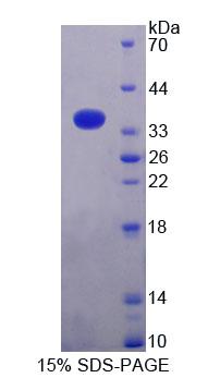 MRPL2 Protein - Recombinant Mitochondrial Ribosomal Protein L2 (MRPL2) by SDS-PAGE