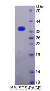 MRPL2 Protein - Recombinant Mitochondrial Ribosomal Protein L2 (MRPL2) by SDS-PAGE