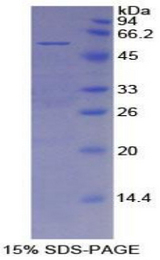 MSLN / Mesothelin Protein - Recombinant Mesothelin By SDS-PAGE