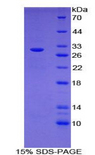 MST1 Protein - Recombinant Macrophage Stimulating Protein By SDS-PAGE