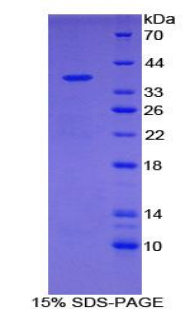 MT-ND1 Protein - Recombinant NADH Dehydrogenase 1 By SDS-PAGE