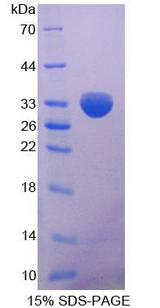 MTAP Protein - Recombinant Methylthioadenosine Phosphorylase By SDS-PAGE