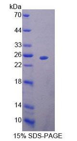 MTF-1 Protein - Recombinant Metal Regulatory Transcription Factor 1 By SDS-PAGE