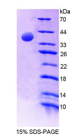 MTFMT Protein - Recombinant  Mitochondrial Methionyl tRNA Formyltransferase By SDS-PAGE
