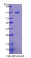 MTPN / Myotrophin Protein - Recombinant  Myotrophin By SDS-PAGE