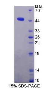 MTTP / MTP Protein - Recombinant  Microsomal Triglyceride Transfer Protein By SDS-PAGE