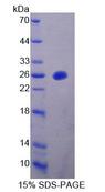 MTUS1 Protein - Recombinant Mitochondrial Tumor Suppressor 1 By SDS-PAGE