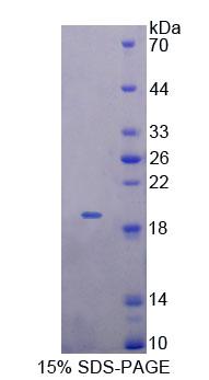 MTX1 / Metaxin 1 Protein - Recombinant Metaxin 1 By SDS-PAGE