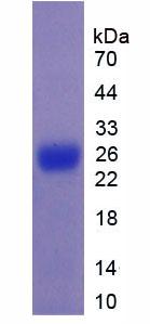 MUC5B Protein - Recombinant Mucin 5 Subtype B By SDS-PAGE