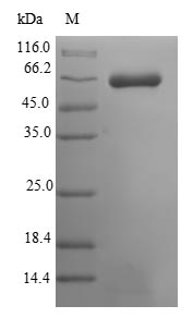 MUSK Protein - (Tris-Glycine gel) Discontinuous SDS-PAGE (reduced) with 5% enrichment gel and 15% separation gel.