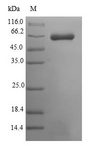 MUSK Protein - (Tris-Glycine gel) Discontinuous SDS-PAGE (reduced) with 5% enrichment gel and 15% separation gel.