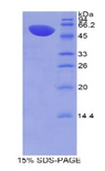 MX1 / MX Protein - Recombinant Myxovirus Resistance 1 By SDS-PAGE