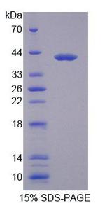 MYH1 Protein - Recombinant Myosin Heavy Chain 1, Skeletal Muscle, Adult By SDS-PAGE