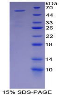 MYH2 Protein - Recombinant Myosin Heavy Chain 2, Skeletal Muscle, Adult By SDS-PAGE