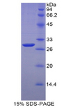 MYH4 Protein - Recombinant Myosin Heavy Chain 4, Skeletal Muscle By SDS-PAGE