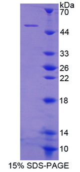 MYL3 Protein - Recombinant  Myosin Light Chain 3, Alkali, Ventricular, Slow Skeletal By SDS-PAGE