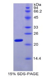 MYL4 Protein - Recombinant Myosin Light Chain 4, Alkali, Atrial, Embryonic By SDS-PAGE